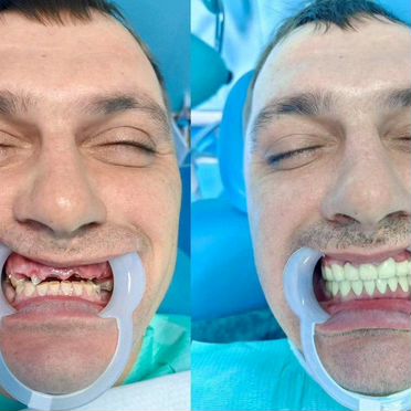Тур в Китай с лечением зубов